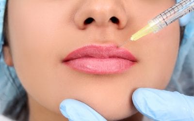 Lip Filler Leeds at Medifine Aesthetics