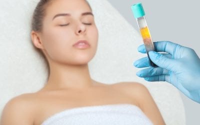 PRP – Platelet Rich Plasma in Leeds at Medifine Aesthetics