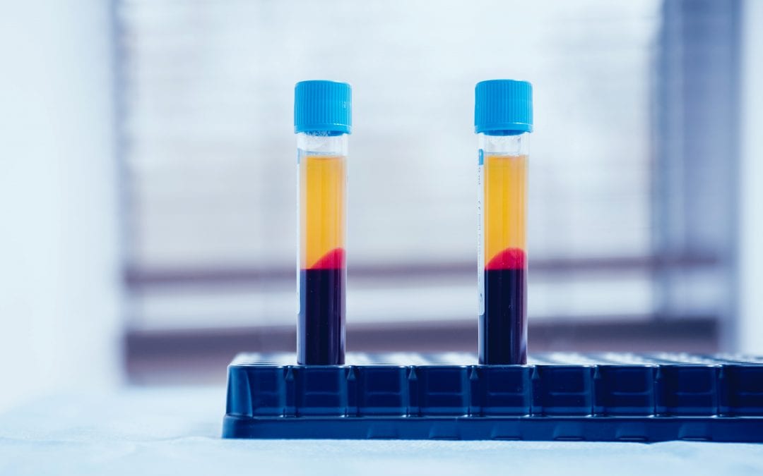 PRP – Platelet Rich Plasma Leeds