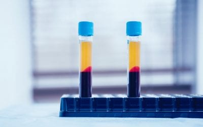 PRP – Platelet Rich Plasma Leeds