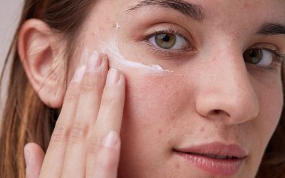 Do I need to use a moisturiser if I have acne?