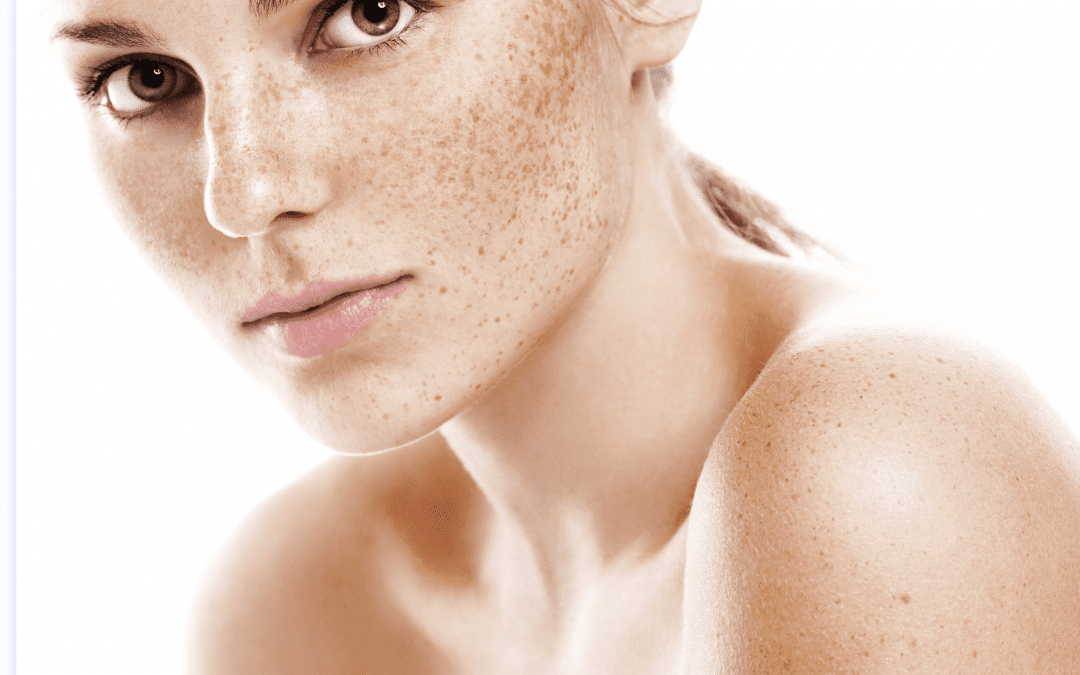 Why DNA Repair Enzymes complement hyperpigmentation treatments?