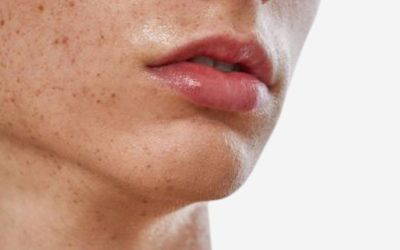 The Secret to Healthy Skin: Nurturing Your Skin Microbiome