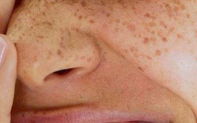 The Science of Pigment, Protection and More Even-Looking Skin – Melanin Essentials